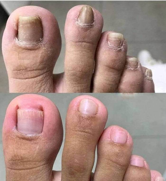Antes y después de Marta