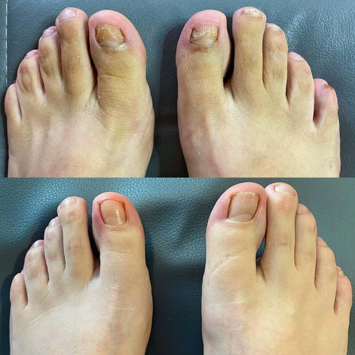 Antes y después de Domingo