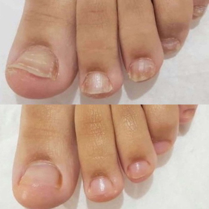 Antes y después de Claudia