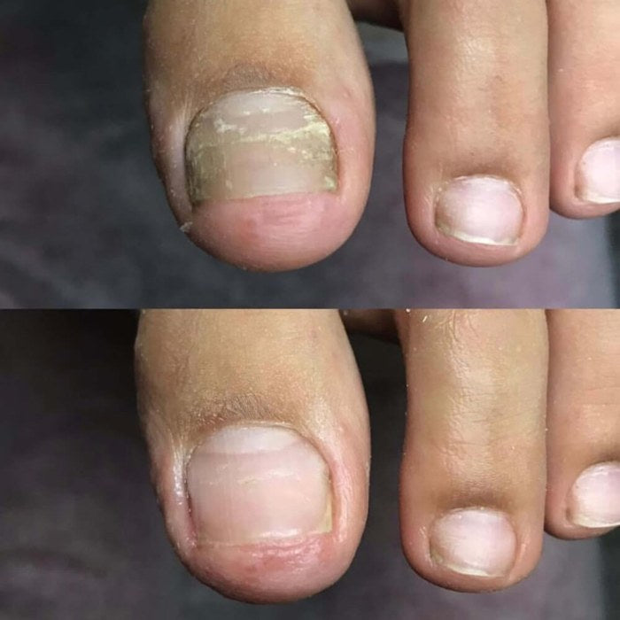 Antes y después de Raúl
