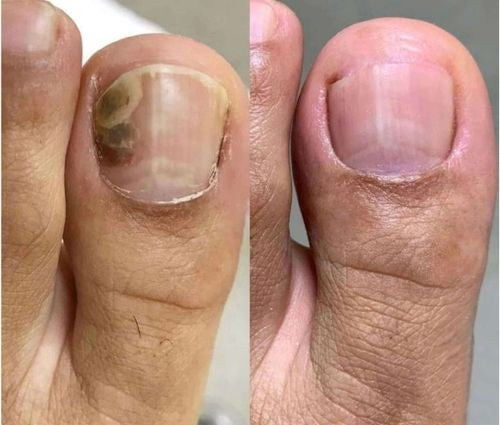 Antes y después de Maite